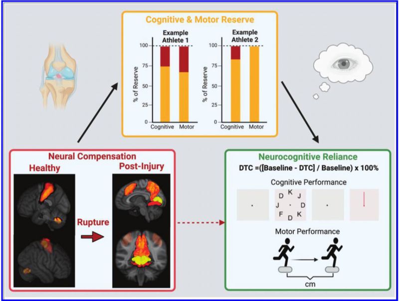 Diagram illustrating cognitive and motor reserve with bar charts for Athlete 1 and Athlete 2, showing percentages of cognitive and motor reserve. An arrow points from a knee injury image to brain scans of healthy and post-injury neural compensation, leading to a neurocognitive reliance section with DTC formula and cognitive/motor performance indicators, connected to a running figure.